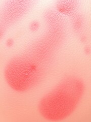 Close-up of red, inflamed skin with rash caused by allergic dermatitis, healthcare