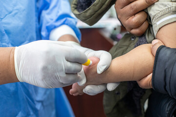 Tamizaje de hemoglobina para detectar anemia en bebés - Hemoglobin screening to detect anemia in babies