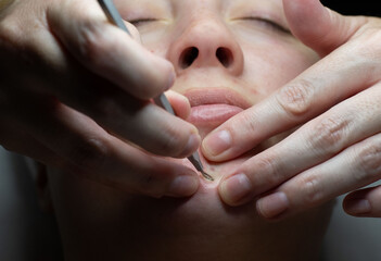 woman getting facial