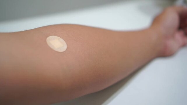 A medical adhesive bandage is placed on the injection site after blood sample collection to prevent bleeding and maintain cleanliness. 