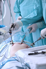 Laparoscopic instruments in hands of surgeon. Modern abdominal surgery. Laparoscopy in surgery....