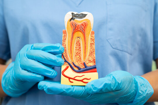 Dental implant, artificial tooth roots into jaw, root canal of dental treatment, gum disease, teeth model for dentist studying about dentistry.