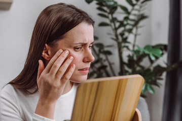Unhappy young caucasian woman looking in mirror, allergy presenting allergic reaction from cosmetic...