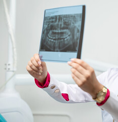 Dentist hold xray scan
