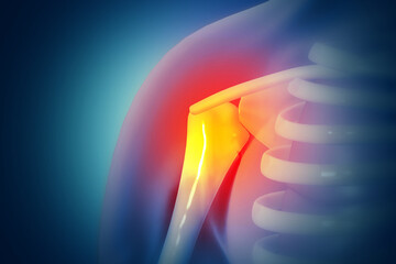 Human shoulder joint pain, x-ray view, shoulder ligament tendinitis, shoulder muscle strain. 3d illustration