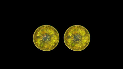 Obraz premium Testate amoeba Arcella under a microscope, family Arcellidae, class Tubulinea. Enclosed in a chitinous shell. They feed on algae, protozoa. Volga River