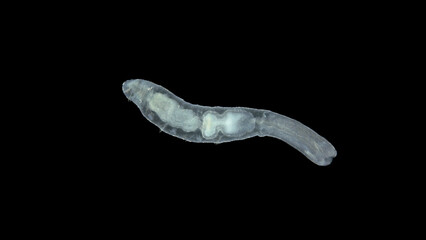 Worm Chaetogaster sp. under the microscope, class Oligochaeta. Lives in fresh water. They feed by...