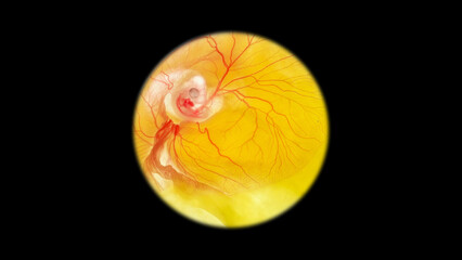 Chicken embryo under a microscope, on the third day of development. Visible blood vessels