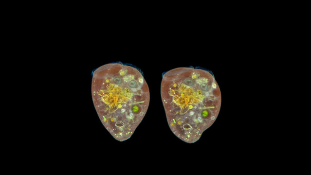 Infusoria Stentor under the microscope, family Stentoridae, class Ciliata, feed on small organic residues, bacteria, algae, protozoa.In the stomach you can see the shells of Rotifera Keratella, which