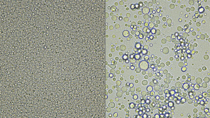 Milk under a microscope, on the video on the left, from the store that was processed - pasteurization, and on the right is fresh rustic - there is a noticeable difference in the composition of useful