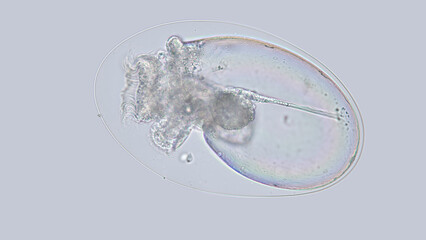 Egg with Mollusca Nudibranchia embryo under a microscope, possibly Superfamily Fionoidea. They are...
