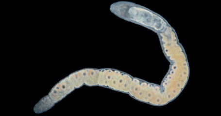 Nemertea worm under a microscope, class Hoplonemertea, order Monostilifera. Female with eggs. White...