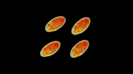 Ciliophora under a microscope, class Ciliata. Black Sea