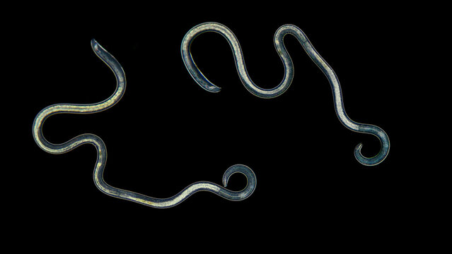 Nematoda worm under a microscope, type Protostomia. There are both parasitic and free-living