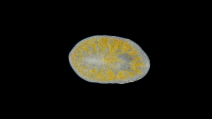 Worm order Polycladida under a microscope, possibly Leptoplana sp. The specimen was found in the White Sea.