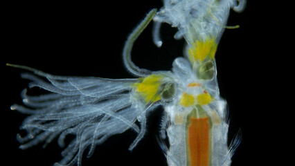 Polychaeta worm, order Sabellida under a microscope. Family Fabriciidae. Filters living in tubes of sand, shell fragments, glued together with mucus. Red Sea