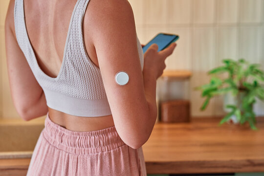 Young girl with diabetes uses smart remote sensor for monitoring of blood sugar level at home, modern active diabetic lifestyle