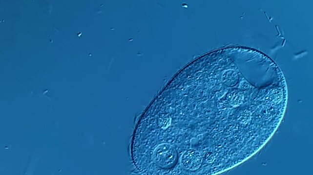 Ciliates under DIC microscope 