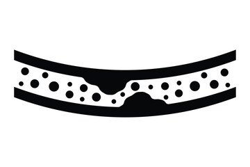 High blood cholesterol icon with a arteriosclerosis risk. Clogged artery. Concept of high cholesterol and unhealthy lifestyle, fast food. thrombosis microvascular disease. Vector illustration symbol.