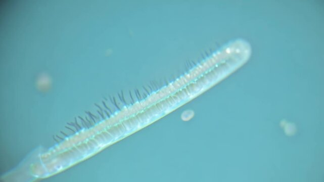 Paramecium aurelia swimming showing trichocysts and cilia
