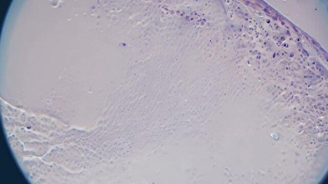 Microscope showing human skin tissue samples