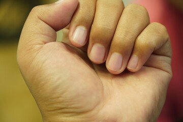 A close-up view of a person's hand, showcasing their fingernails and skin texture.