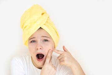 portrait of a teenage girl with bad emotion - she removes pimples from her forehead, touches her face, acne on the skin, concept of beauty and health