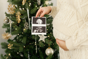 Happy pregnant woman in knitted outfit holding ultrasound scan of baby and hugging belly on...