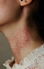 Fototapeta premium Close-up of a woman's neck with red peeling on the skin