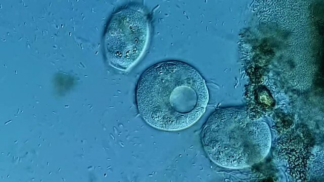 Movement of protozoa under DIC microscope 
