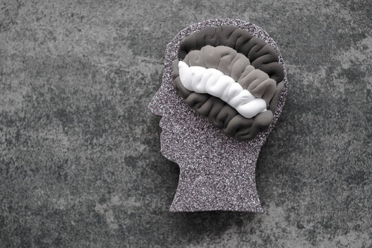 Problems with mental health, disorder of the nervous system, depression, changes in behavior. top view