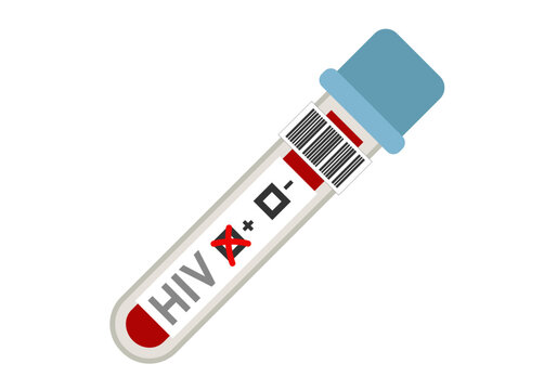 Prueba de detecci&oacute;n de vih o sida positiva 
