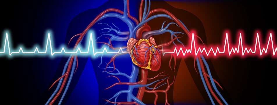 Congestive Heart Failure or CHF as a heart condition resulting in human cardiac failure as an ekg or ecg symbol with an irregular heart beat as a cardiovascular organ unable to pump blood effectively.