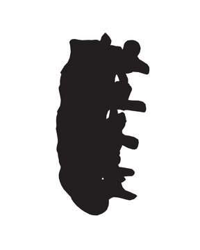 recommend clip art: Silhouette Anatomy of normal human Disc. Illustration of Medical diagram about the spine in top view for check disc herniation. nucleus pulposus, annulus fibrosis.