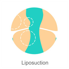 Liposuction
