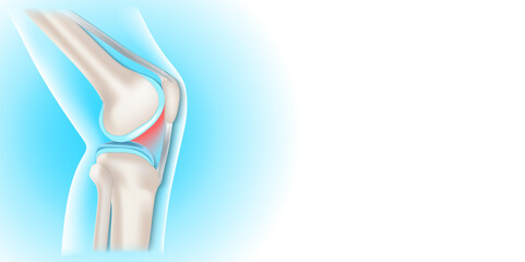 Side view of human knee.