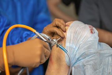 Orthopedic surgeons learn to perform knee surgery.