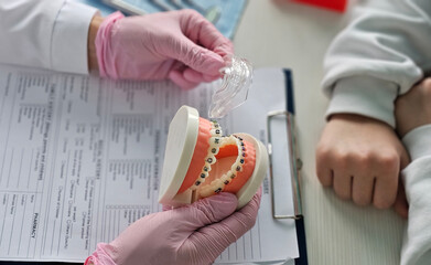 Dental explaining braces and oral care with a model during a consultation