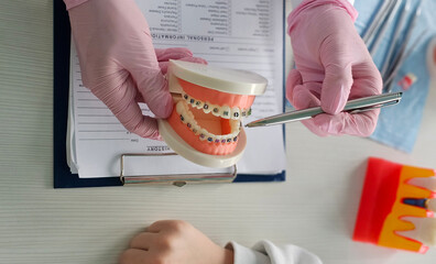 Dentist discussing orthodontic model with braces with teenager concept
