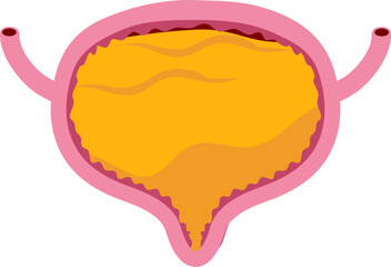 Bladder disease illustration. Urinary tract infection. Bladder cancer. Bladder stones. Bladder inconvenience.