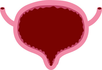 Bladder disease illustration. Urinary tract infection. Bladder cancer. Bladder stones. Bladder inconvenience.