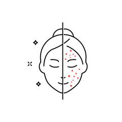 Woman with Acne and Clean Face Skin Line Icon. Female Skincare for Cleansing Face and Problem Skin Outline Icon. Girl Before and After Skin Treatment