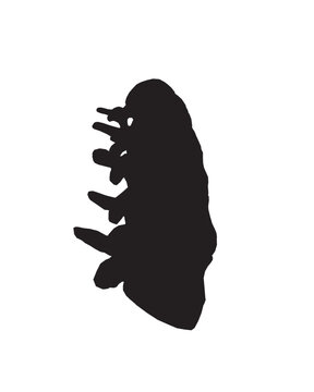 recommend clip art: Silhouette Anatomy of normal human Disc. Illustration of Medical diagram about the spine in top view for check disc herniation. nucleus pulposus, annulus fibrosis.