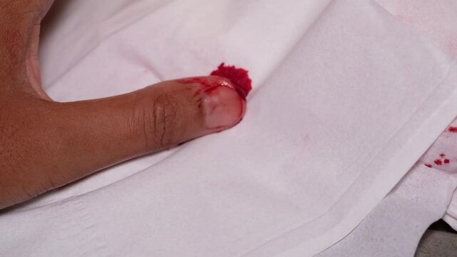 Footage of Bloody Thumb Wiped on Tissue. Video of Workplace Accident in Kitchen. Thumb Full of Blood. Disturbing and Mature Content. Gore and Bloody. Halloween