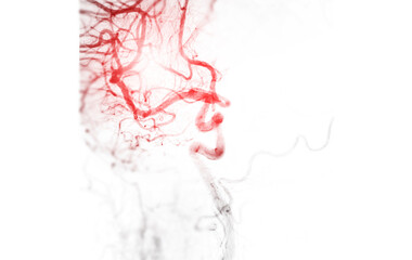 A detailed cerebral angiogram showcasing intricate blood vessels in the brain. The image highlights...