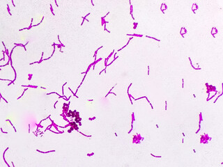 Streptococcus pneumonia bacteria cells and candida albican fungus form hemoculture micrograph.