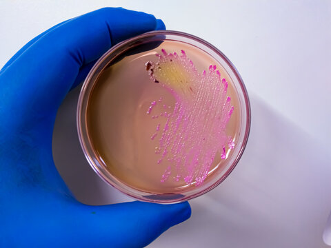 Salmonella Typhi colony on Macconkey agar