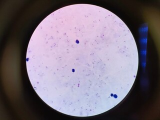 Plasmodium falciparum is a unicellular protozoan parasite of humans, and the deadliest species of Plasmodium that causes malaria in humans.