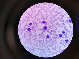 Human blood cells as seen under a microscope