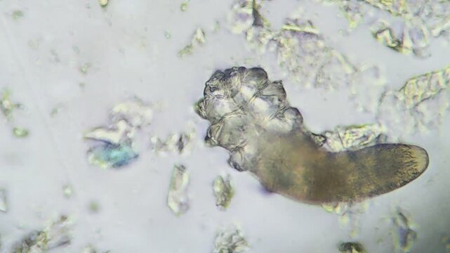 viable Demodex moving under the microscope, on a white surface, showcasing its slow movement